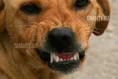 После укуса собаки в Шахтах Бастрыкин дал указание возбудить уголовное дело