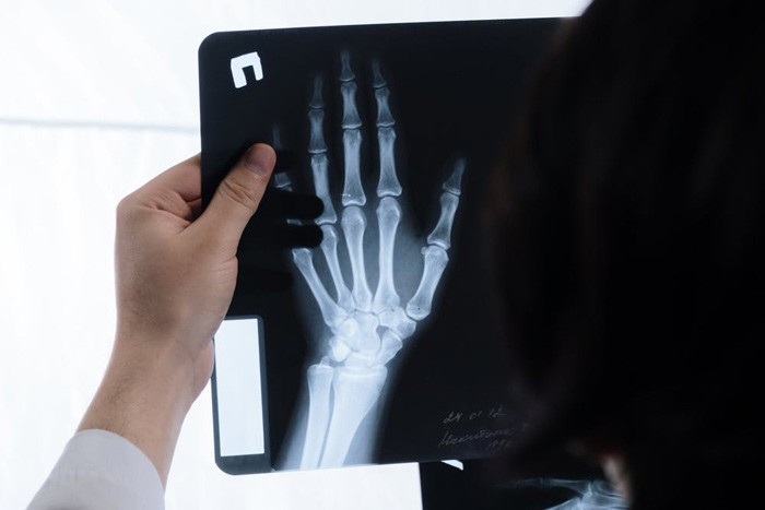 Бизнесмен из Шахт продал поддельный рентген в больницу № 20 Ростова, считает следствие