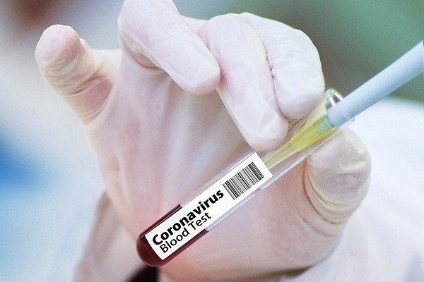 В Ростовской области 653 аппарата искусственной вентиляции легких (ИВЛ)